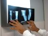 Dor fêmuro-patelar
