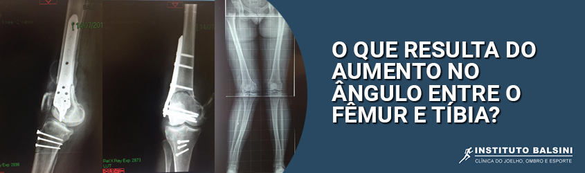 o que resulta do aumento no angulo entre o femur e tibia